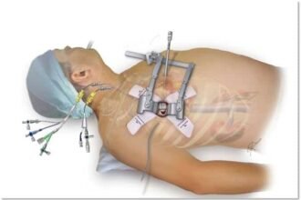 جراحة القلب بالمنظار: أحدث تقنيات جراحة القلب طفيفة التوغل