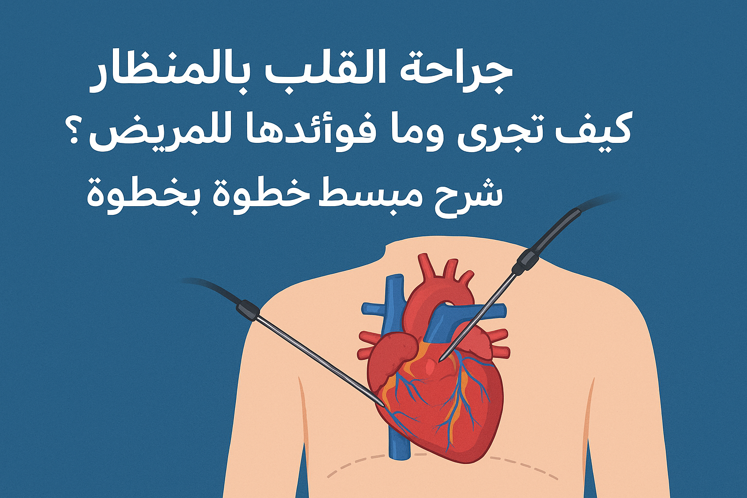 جراحة القلب بالمنظار: كيف تُجرى وما فوائدها للمريض؟ شرح مبسّط خطوة بخطوة